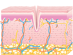 Untreated Skin/Collagen Remodeling Occurs | TempSure